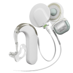 SYNCHRONY EAS Hearing Implant System